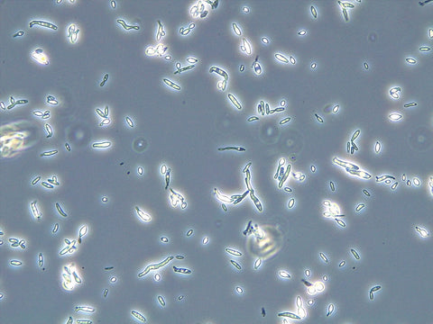 Bottle Sterility Plating